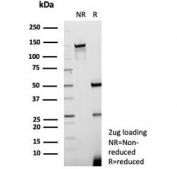 SDS-PAGE analysis of purified, BSA-free recombinant Kallikrein 7 antibody (clone KLK7/8971R) as confirmation of integrity and purity.