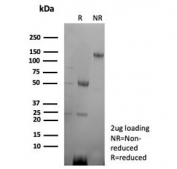 SDS-PAGE analysis of purified, BSA-free CD2 antibody (clone LFA2/8845R) as confirmation of integrity and purity.