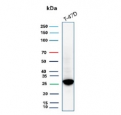 Western blot testing of human T-47D cell lysate with recombinant GSTM3 antibody (clone rGSTM3/8878).