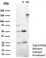 SDS-PAGE analysis of purified, BSA-free Ob-R antibody (clone LEPR/4545) as confirmation of integrity and purity.