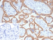 IHC staining of FFPE human placental tissue with L1TD1 antibody (clone L1TD1/7941). Inset: PBS used in place of primary Ab (secondary Ab negative control). HIER: boil tissue sections in pH 9 10mM Tris with 1mM EDTA for 20 min and allow to cool before testing.