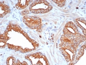 IHC staining of FFPE human prostate tissue with L1TD1 antibody (clone L1TD1/7941). HIER: boil tissue sections in pH 9 10mM Tris with 1mM EDTA for 20 min and allow to cool before testing.