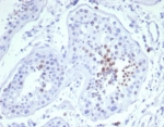 IHC staining of FFPE human testis tissue with Mitotic centromere associated kinesin antibody (clone KIF2C/6523) at 2ug/ml. HIER: boil tissue sections in pH 9 10mM Tris with 1mM EDTA for 20 min and allow to cool before testing.