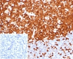 IHC staining of FFPE human tonsil tissue with Stathmin 1 antibody (clone STMN1/8001R). Inset: PBS used in place of primary Ab (secondary Ab negative control). HIER: boil tissue sections in pH 9 10mM Tris with 1mM EDTA for 20 min and allow to cool before testing.