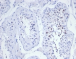 IHC staining of FFPE human testis tissue with KIF2C antibody (clone KIF2C/6525) at 2ug/ml. HIER: boil tissue sections in pH 9 10mM Tris with 1mM EDTA for 20 min and allow to cool before testing.
