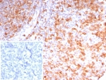 IHC staining of FFPE human tonsil tissue with Stathmin 1 antibody (clone STMN1/8023R). Inset: PBS used in place of primary Ab (secondary Ab negative control). HIER: boil tissue sections in pH 9 10mM Tris with 1mM EDTA for 20 min and allow to cool before testing.