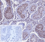 IHC staining of FFPE human testis tissue with Kinesin Family Member 2C antibody (clone KIF2C/4707) at 2ug/ml. Inset: PBS used in place of primary Ab (secondary Ab negative control). HIER: boil tissue sections in pH 9 10mM Tris with 1mM EDTA for 20 min and allow to cool before testing.