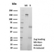 SDS-PAGE analysis of purified, BSA-free Kinesin Family Member 2C antibody (clone KIF2C/6518) as confirmation of integrity and purity.