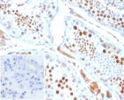 IHC staining of FFPE human testis tissue with Kinesin Family Member 2C antibody (clone KIF2C/6518) at 2ug/ml. Inset: PBS used in place of primary Ab (secondary Ab negative control). HIER: boil tissue sections in pH 9 10mM Tris with 1mM EDTA for 20 min and allow to cool before testing.