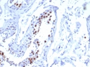 IHC staining of FFPE human testis tissue with Kinesin Family Member 2C antibody (clone KIF2C/6518) at 2ug/ml. HIER: boil tissue sections in pH 9 10mM Tris with 1mM EDTA for 20 min and allow to cool before testing.