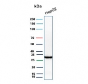 Western blot testing of human HepG2 cell lysate with Succinate dehydrogenase B antibody. Predicted molecular weight 25-32 kDa.
