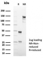 SDS-PAGE analysis of purified, BSA-free recombinant PDPN antibody (clone rPDPN/6994) as confirmation of integrity and purity.