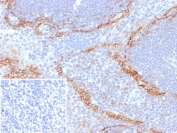 IHC staining of FFPE human tonsil tissue with recombinant PDPN antibody (clone rPDPN/6994). Inset: PBS used in place of primary Ab (secondary Ab negative control). HIER: boil tissue sections in pH 9 10mM Tris with 1mM EDTA for 20 min and allow to cool before testing.