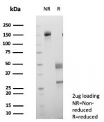 SDS-PAGE analysis of purified, BSA-free SLC2A1 antibody (clone GLUT1/7308) as confirmation of integrity and purity.