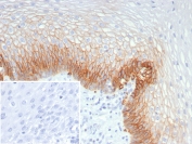 IHC staining of FFPE human esophagus tissue with SLC2A1 antibody (clone GLUT1/7308). Inset: PBS used in place of primary Ab (secondary Ab negative control). HIER: boil tissue sections in pH 9 10mM Tris with 1mM EDTA for 20 min and allow to cool before testing.