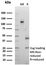 SDS-PAGE analysis of purified, BSA-free Stathmin 1 antibody (clone STMN1/8012) as confirmation of integrity and purity.