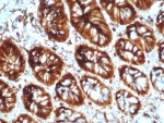IHC staining of FFPE human colon tissue with Stathmin 1 antibody (clone STMN1/8012). HIER: boil tissue sections in pH 9 10mM Tris with 1mM EDTA for 20 min and allow to cool before testing.