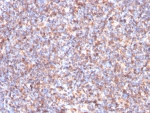 IHC staining of FFPE human tonsil tissue with Succinate dehydrogenase B antibody (clone SDHB/3204). HIER: boil tissue sections in pH 9 10mM Tris with 1mM EDTA for 20 min and allow to cool before testing.