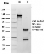 SDS-PAGE analysis of purified, BSA-free SDHB antibody (clone SDHB/3745) as confirmation of integrity and purity.