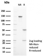SDS-PAGE analysis of purified, BSA-free S100A9 antibody (clone S100A9/7550) as confirmation of integrity and purity.