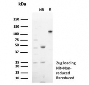 SDS-PAGE analysis of purified, BSA-free recombinant CD48 antibody (clone CD48/8602R) as confirmation of integrity and purity.