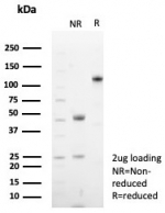 SDS-PAGE analysis of purified, BSA-free recombinant CD48 antibody (clone CD48/8602R) as confirmation of integrity and purity.
