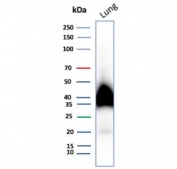 IHC staining of FFPE human tonsil tissue with Gp36 antibody (clone PDPN/7808R). Inset: PBS used in place of primary Ab (secondary Ab negative control). HIER: boil tissue sections in pH 9 10mM Tris with 1mM EDTA for 20 min and allow to cool before testing.