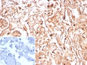 IHC staining of FFPE human tonsil tissue with Podoplanin antibody (clone PDPN/8950R). Inset: PBS used in place of primary Ab (secondary Ab negative control). HIER: boil tissue sections in pH 9 10mM Tris with 1mM EDTA for 20 min and allow to cool before testing.