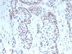 IHC staining of FFPE human prostate tissue with TARDBP antibody (clone TARDP/349). HIER: boil tissue sections in pH 9 10mM Tris with 1mM EDTA for 20 min and allow to cool before testing.