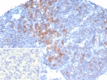 IHC staining of FFPE human lymph node tissue with PIK3CD antibody (clone PIK3CD/4639). Inset: PBS used in place of primary Ab (secondary Ab negative control). HIER: boil tissue sections in pH 9 10mM Tris with 1mM EDTA for 20 min and allow to cool before testing.
