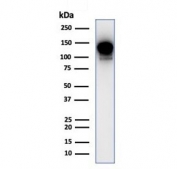 Western blot testing of human THP-1 cell lysate with PIK3CD antibody (clone PIK3CD/4639). Expected molecular weight: 110-120 kDa.