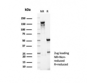 SDS-PAGE analysis of purified, BSA-free PIK3CD antibody (clone PIK3CD/4639) as confirmation of integrity and purity.