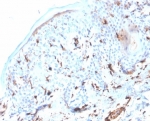 IHC staining of FFPE human skin tissue with S100A4 antibody (clone S100A4/6995). HIER: boil tissue sections in pH 9 10mM Tris with 1mM EDTA for 20 min and allow to cool before testing.