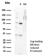 SDS-PAGE analysis of purified, BSA-free MRP14 antibody (clone S100A9/7547) as confirmation of integrity and purity.