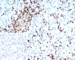 IHC staining of FFPE human spleen tissue with S100A4 antibody (clone S100A4/7097). Inset: PBS used in place of primary Ab (secondary Ab negative control). HIER: boil tissue sections in pH 9 10mM Tris with 1mM EDTA for 20 min and allow to cool before testing.