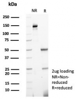 SDS-PAGE analysis of purified, BSA-free Calprotectin antibody (clone S100A9/7551) as confirmation of integrity and purity.