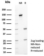 SDS-PAGE analysis of purified, BSA-free Calprotectin antibody (clone S100A9/7548) as confirmation of integrity and purity.