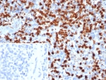 IHC staining of FFPE human spleen tissue with Calprotectin antibody (clone S100A9/7548). Inset: PBS used in place of primary Ab (secondary Ab negative control). HIER: boil tissue sections in pH 9 10mM Tris with 1mM EDTA for 20 min and allow to cool before testing.