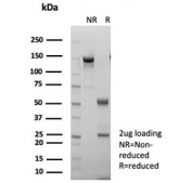 SDS-PAGE analysis of purified, BSA-free S100A14 antibody (clone S100A14/7403) as confirmation of integrity and purity.