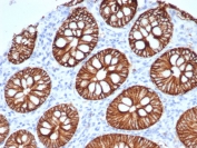 IHC staining of FFPE human normal colon with S100A14 antibody (clone S100A14/7401). HIER: boil tissue sections in pH 9 10mM Tris with 1mM EDTA for 20 min and allow to cool before testing.