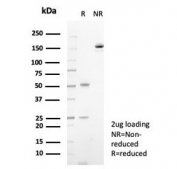 SDS-PAGE analysis of purified, BSA-free S100A14 antibody (clone S100A14/7401) as confirmation of integrity and purity.