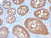 IHC staining of FFPE human colon tissue with S100 calcium-binding protein A14 antibody (clone S100A14/7402). HIER: boil tissue sections in pH 9 10mM Tris with 1mM EDTA for 20 min and allow to cool before testing.