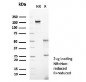 SDS-PAGE analysis of purified, BSA-free S100 calcium-binding protein A14 antibody (clone S100A14/7402) as confirmation of integrity and purity.