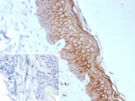 IHC staining of FFPE human skin tissue with recombinant S100A14 antibody (clone S100A14/9077R). Inset: PBS used in place of primary Ab (secondary Ab negative control). HIER: boil tissue sections in pH 9 10mM Tris with 1mM EDTA for 20 min and allow to cool before testing.
