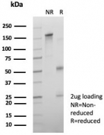SDS-PAGE analysis of purified, BSA-free CD64 antibody (clone FCGR1A/7496) as confirmation of integrity and purity.