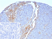 IHC staining of FFPE human tonsil. Membrane stained using FCGR1A/7496 at 2ug/ml. Inset: PBS used in place of primary Ab (secondary Ab negative control). HIER: boil tissue sections in pH 9 10mM Tris with 1mM EDTA for 20 min and allow to cool before testing.