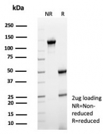 SDS-PAGE analysis of purified, BSA-free CD64 antibody (clone FCGR1A/7498) as confirmation of integrity and purity.
