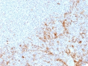 IHC staining of FFPE human tonsil tissue using CD64 antibody (clone FCGR1A/7498) at 2ug/ml. HIER: boil tissue sections in pH 9 10mM Tris with 1mM EDTA for 20 min and allow to cool before testing.