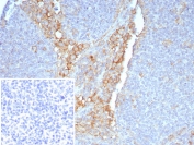 IHC staining of FFPE human tonsil tissue with FCGR1A antibody (clone FCGR1A/7497) at 2ug/ml. Inset: PBS used in place of primary Ab (secondary Ab negative control). HIER: boil tissue sections in pH 9 10mM Tris with 1mM EDTA for 20 min and allow to cool before testing.