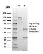 SDS-PAGE analysis of purified, BSA-free S100 Calcium Binding Protein A2 antibody (clone rS100A2/6482) as confirmation of integrity and purity.
